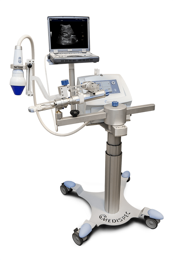 NEPHROSPEC™ — Terapia Renal por Ondas de Choque